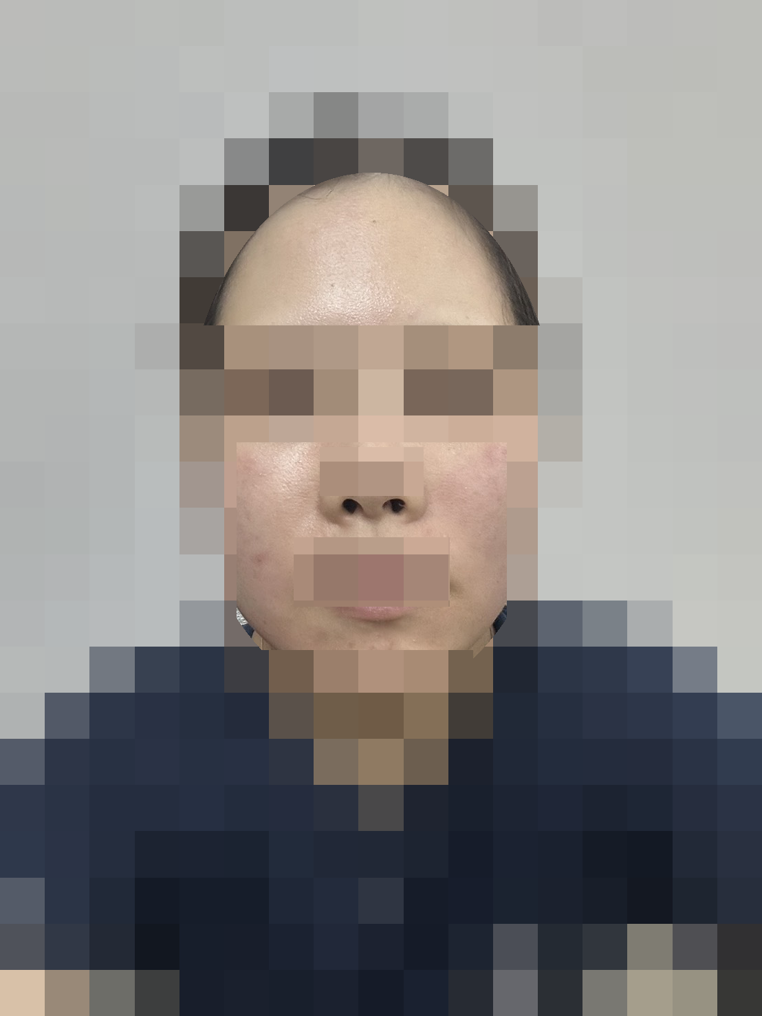 使用前 · 顔の記録