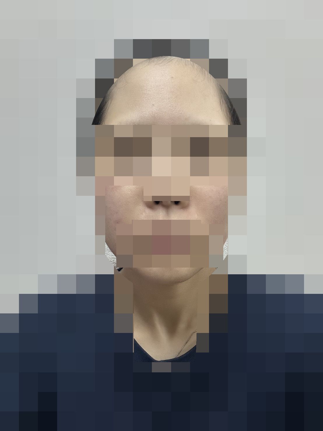 20時頃・再使用後 · 顔の記録