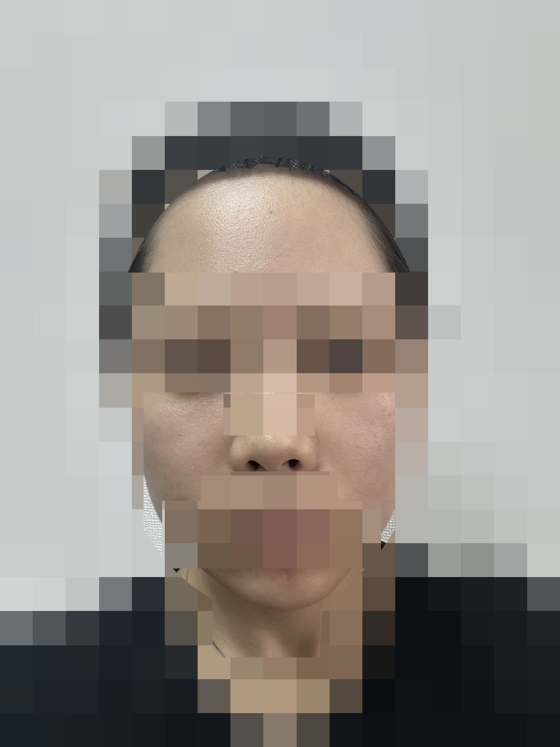 翌日15時頃・再使用前 · 顔の記録