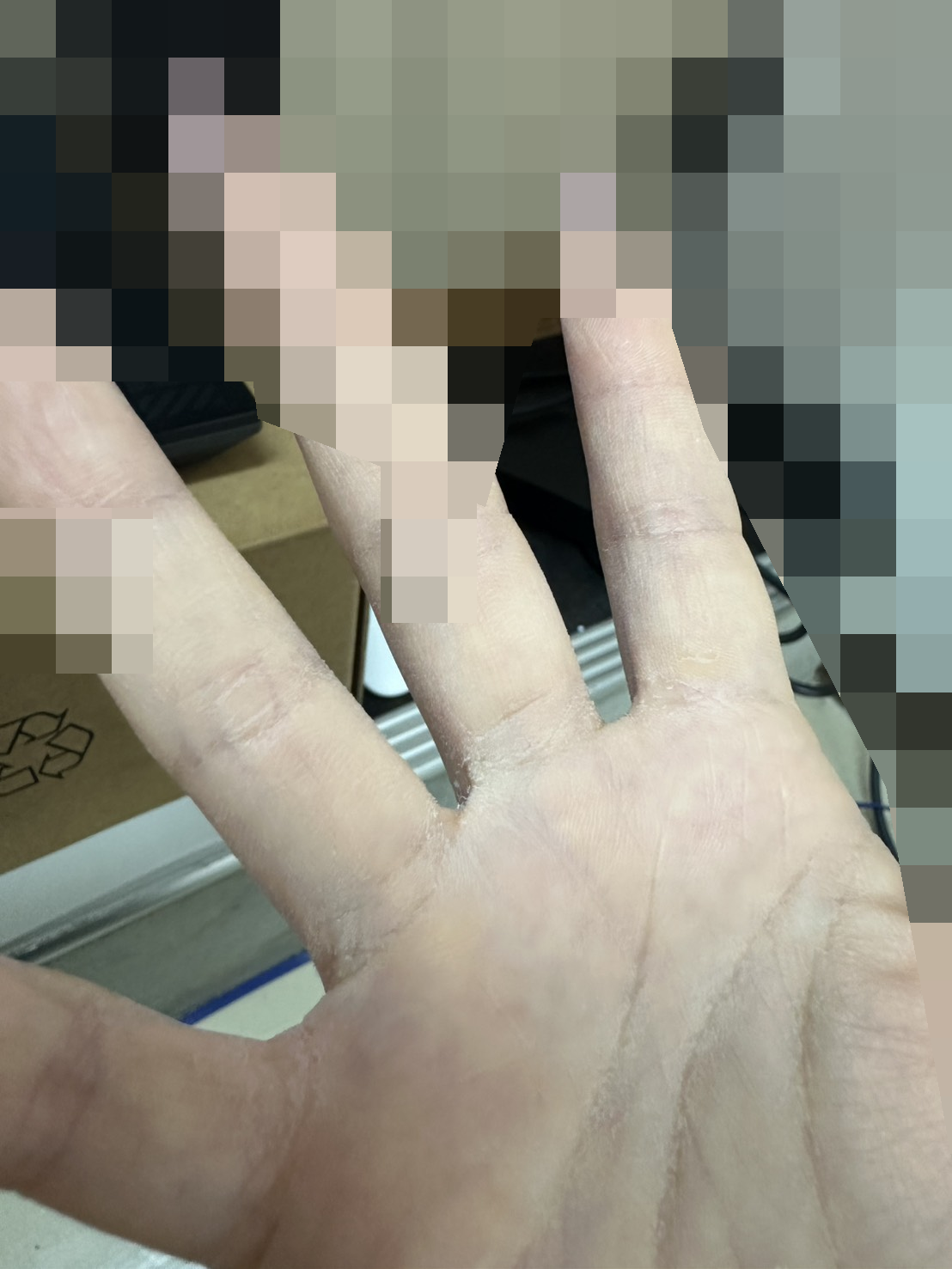 手の乾燥の記録 · 手の記録