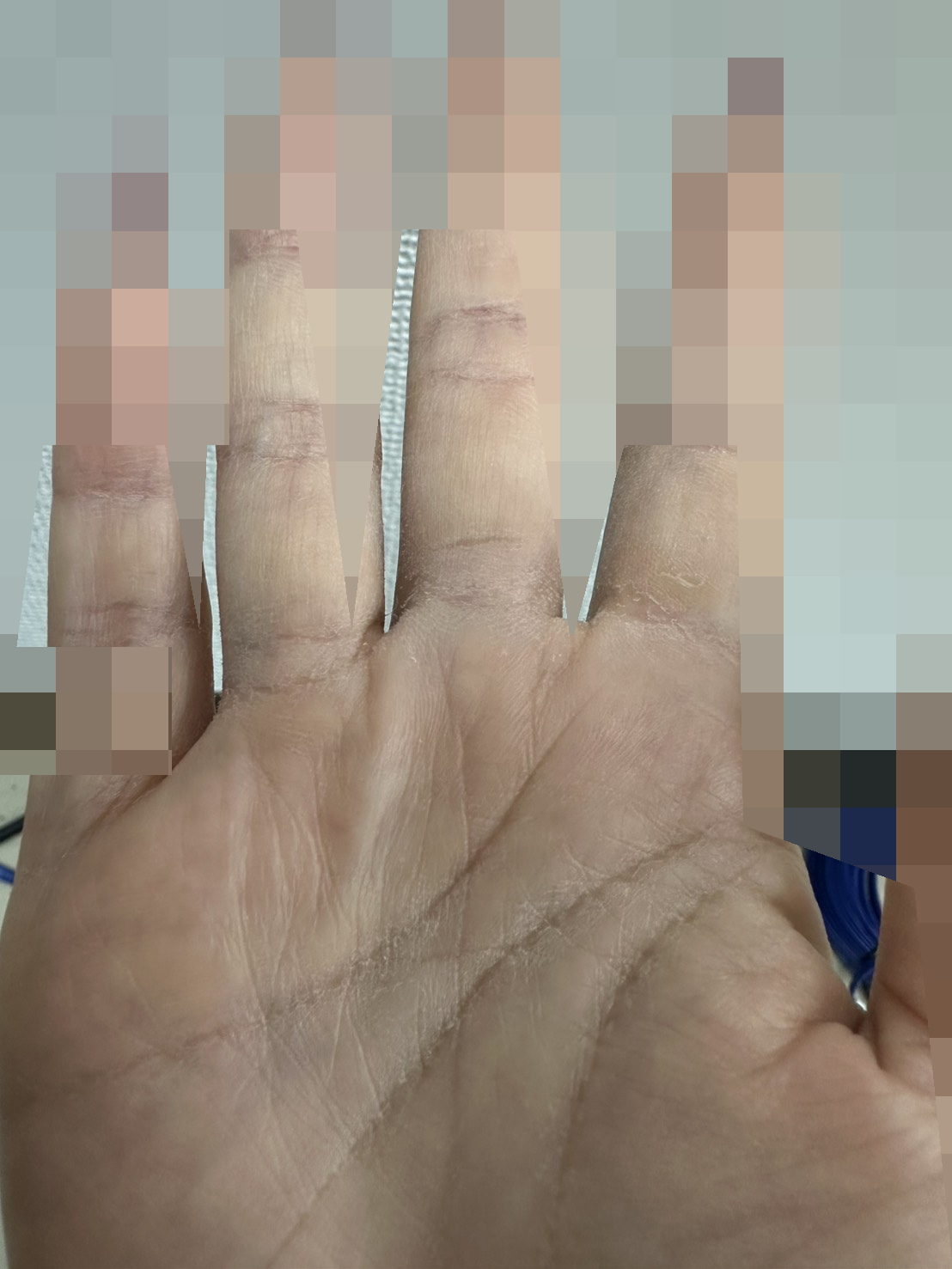 手の乾燥の記録 · 手の記録